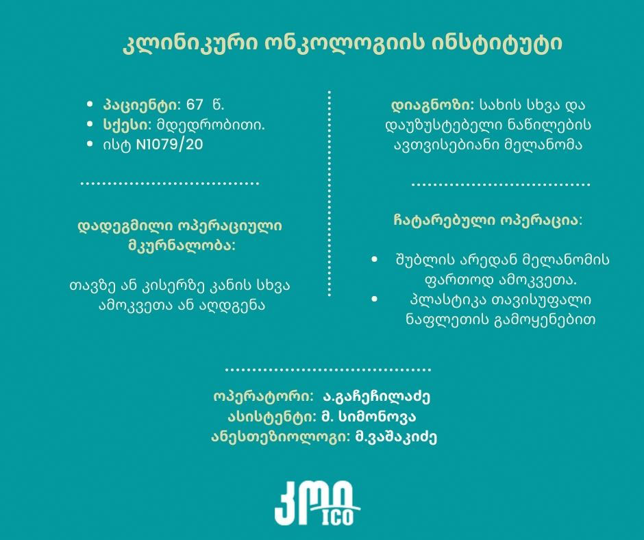 მელანომა